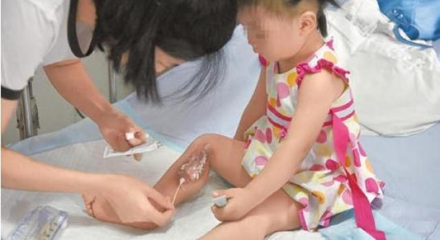 路灯电缆裸露造成事故 2岁女孩被路灯烧伤