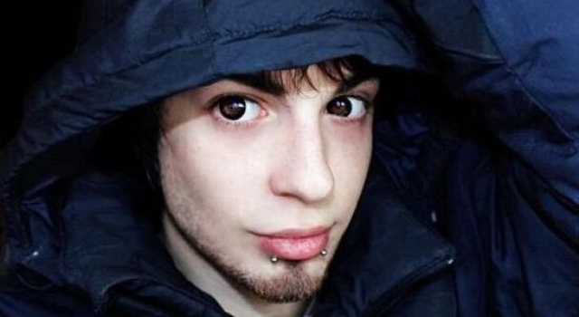男子整容成精灵 痴迷精灵不惜花重金为看起来不像人类