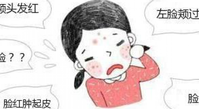 激素脸用什么治疗最好?激素脸用什么药最好