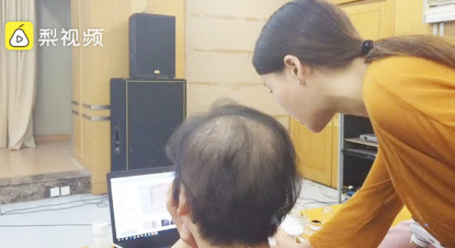 女白领发量剩3成 这叫秃如其来?为什么就3成了?