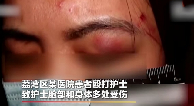 广州医院一男患者殴打女护士 因心情不好 网友:火化吧