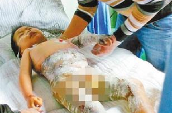 4岁娃意外掉进滚烫豆浆锅内：妈妈，好痛！