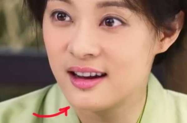孙俪唇痣来历揭秘：因车祸造成 自嘲是女汉子