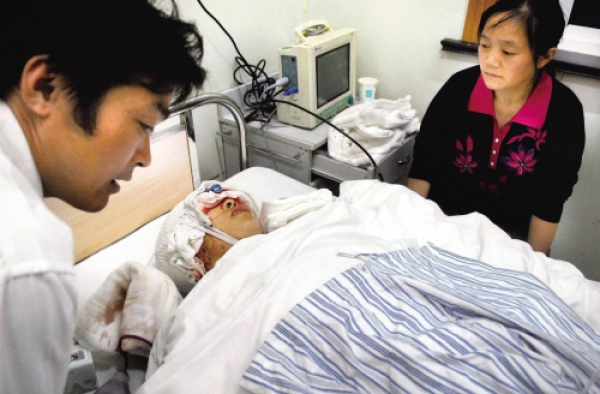 机器"吃"长发:女工及腰长发被卷入车床 缝近千针才救回