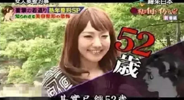 日52岁大妈为做小姐整成少女 3年动刀20次花450万日元