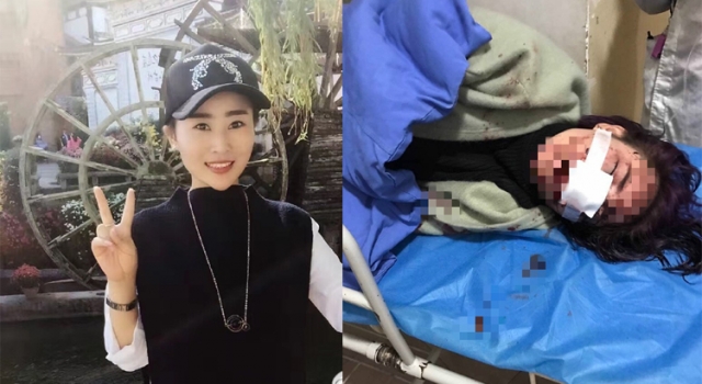 女子在丽江遭暴打抢劫 碎酒瓶划脸做伤情鉴定被拒绝