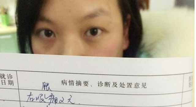 26岁女白领眼睛长满结石 因春节每天追剧至凌晨3点