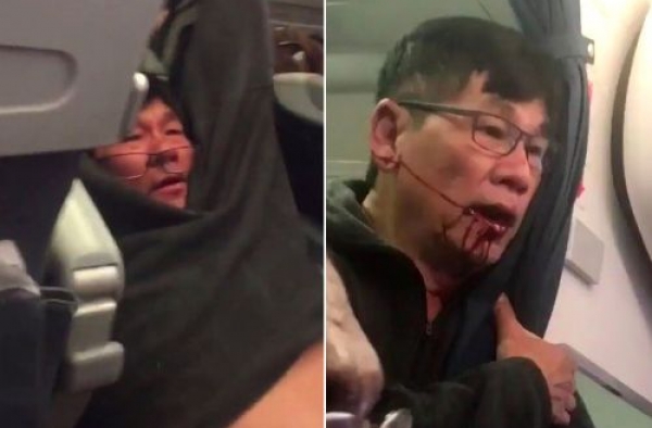 亚裔乘客拖拽门事件后续 女留学生亲历美联航暴力驱客