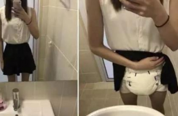 女生发掀裙自拍照惊呆众人 因为它从此离不开尿布