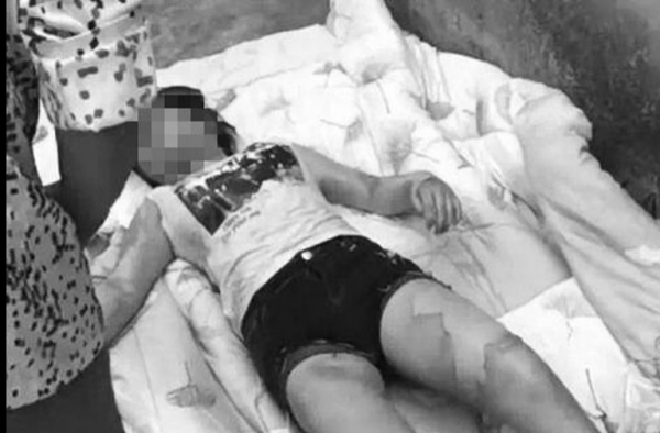 17岁少女遭开水灌嘴怎么回事?暴行背后原因令人愤怒!只因一个猜测