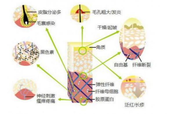 激素脸皮肤过敏怎么办 激素脸经常过敏怎么办