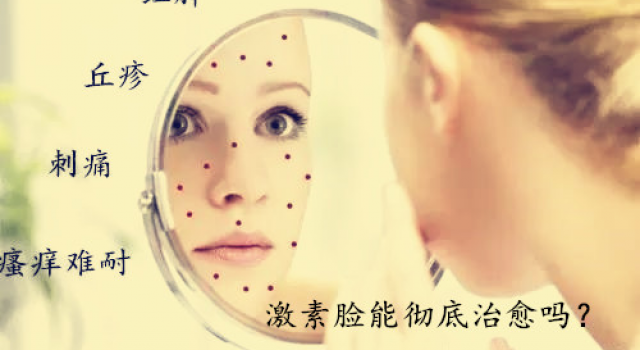重度激素脸有哪些症状？那么激素脸能彻底治愈吗