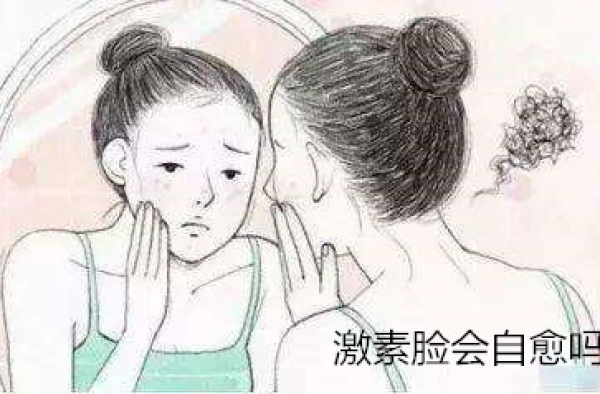 激素脸会自愈吗？那么激素脸痒是在排毒吗