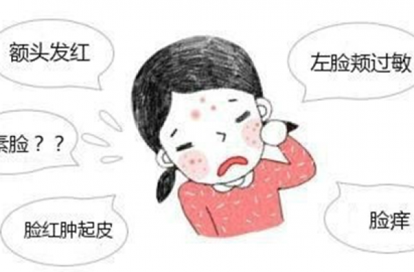 怎么治激素脸最有效？激素脸怎样治疗才会好