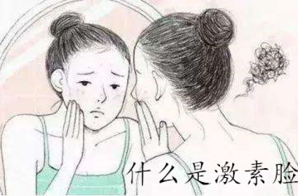 什么是激素脸怎么判断？激素脸怎么修复治疗