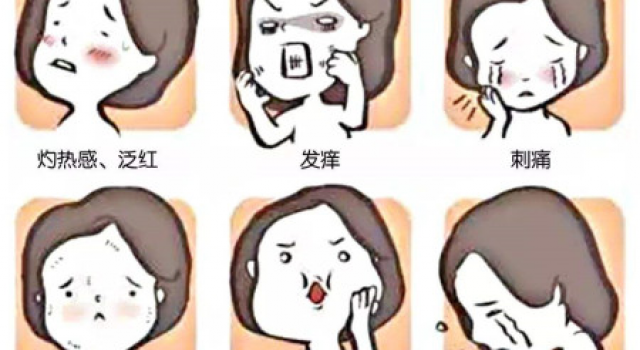 激素脸的表现有哪些？介绍激素脸正确的治疗方法