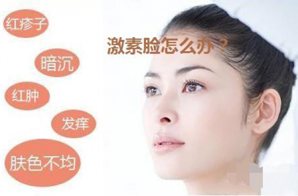 激素脸应该怎么治疗，激素脸多长时间能治愈