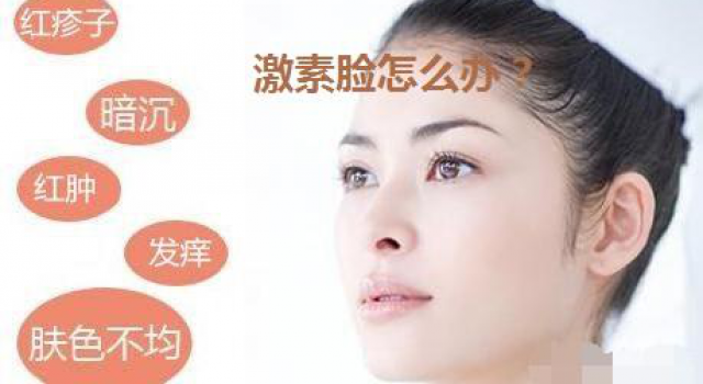 怎样才能调理激素脸？分享激素脸的治疗方法用什么好