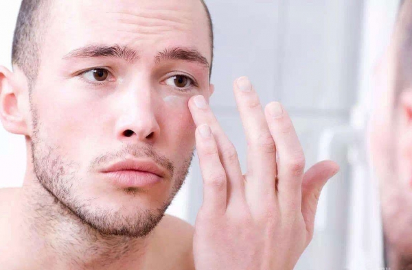 眼霜正确使用方法 眼霜用不对小干纹黑眼圈还找你！