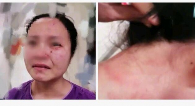 邓主任对广州护士被打事件压制 被全网唾骂惹争议