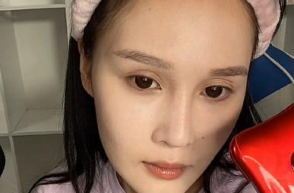 赵本山女儿素颜曝光，双眼皮不自然，微整后长相与父亲复制粘贴