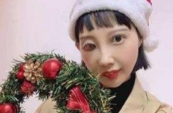 香港女星李明蔚发视频筹款求助，抗癌8年五官已严重变形惹人怜