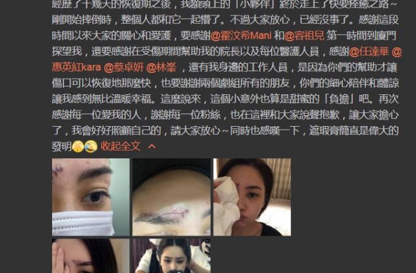 差点毁容！阿娇拆纱布伤口已愈合，额头疤痕曝光缝针清晰可见