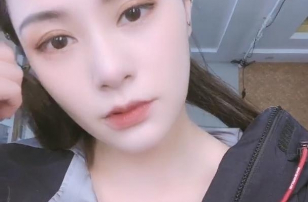 阿娇突晒视频感性发文：感谢你曾经来过，开滤镜后脸上找不见伤疤