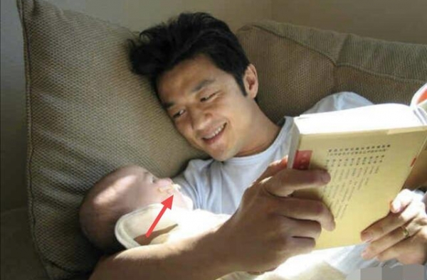 李亚鹏晒李嫣幼年照片，刚做手术嘴上绷带明显，近照不见当年影子