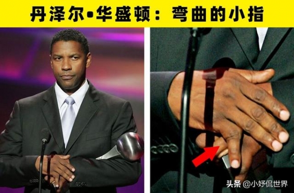9位好莱坞明星身上所拥有的小瑕疵