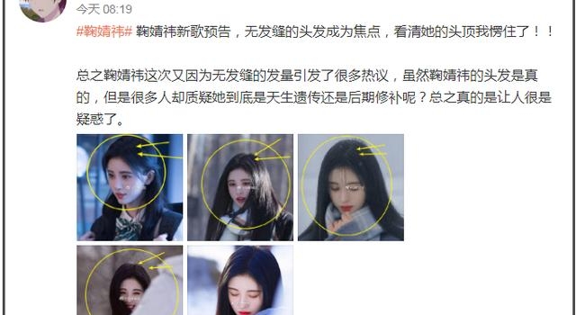 鞠婧祎发量成“未解之谜”，新歌无人care，头顶发缝却成焦点
