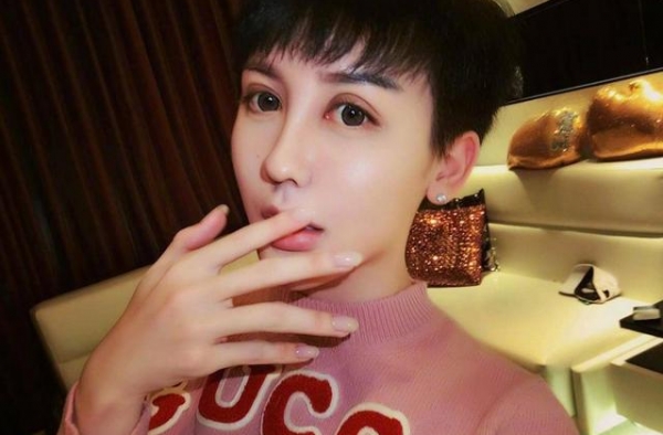 蛇精脸网红刘梓晨确诊新冠！晒检测单直言无助，自曝消失是因毁容